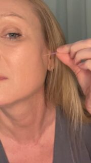 Kæbespændinger, nakkespændinger og hovedpine hænger ofte sammen.

Ikke kun muskulært – men også via nervesystemet og kroppens måde at holde stress på.

Her ser du mig sætte en nål, som bruges specifikt til at afspænde kæben.

Kosmetisk akupunktur arbejder ikke kun lokalt i ansigtet, men i dybden – hvor spændinger, uro og overbelastning ofte har sat sig over tid.

Når kæben slipper, følger resten ofte med:
• mindre tryk i hovedet
• mere bevægelighed i nakken
• en følelse af ro og klarhed

Det er skånsomt, men effektivt.
Og for mange en mærkbar lettelse – både fysisk og mentalt 🤍

Behandlingen tilpasses altid dig og det, din krop fortæller.

Anja
AM Beauty & Care 🤍
.
.
.
.
#stress #akupunktur #hovedpine #metime #ansigtsbehandling